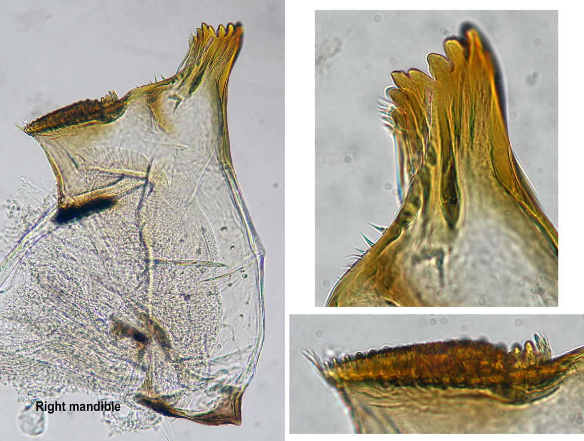 Right mandible