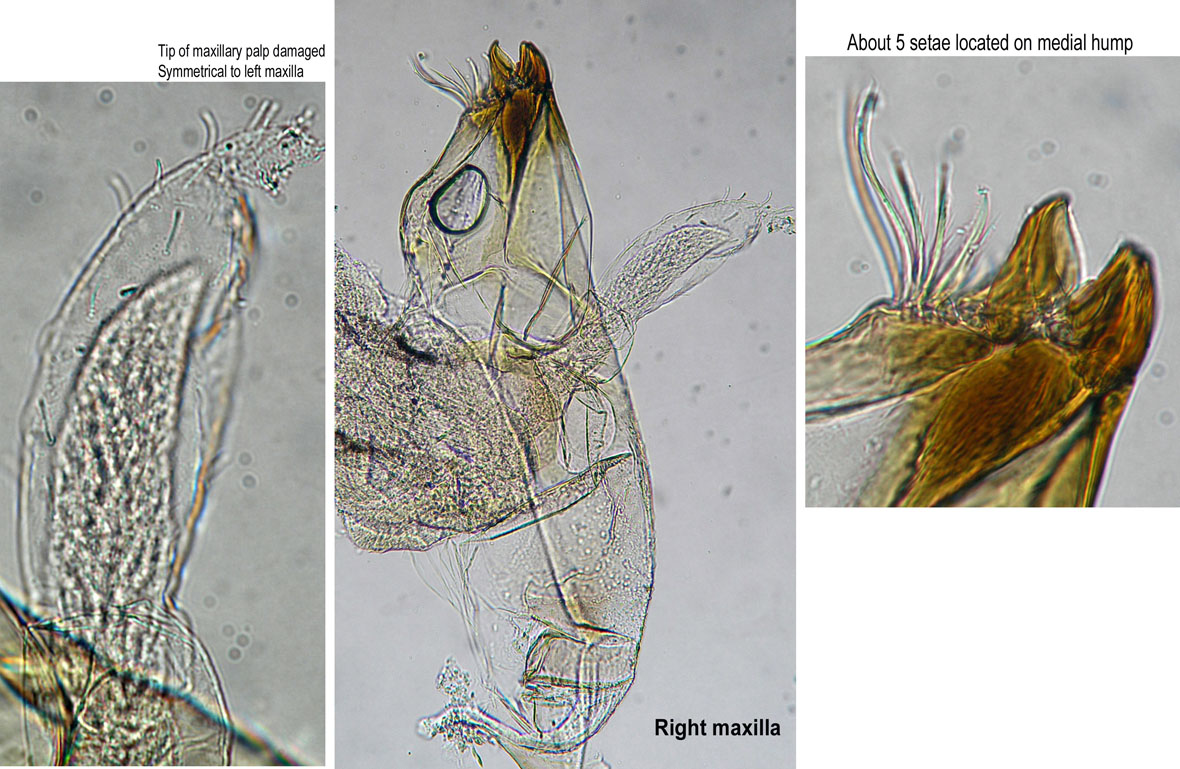 Right maxilla