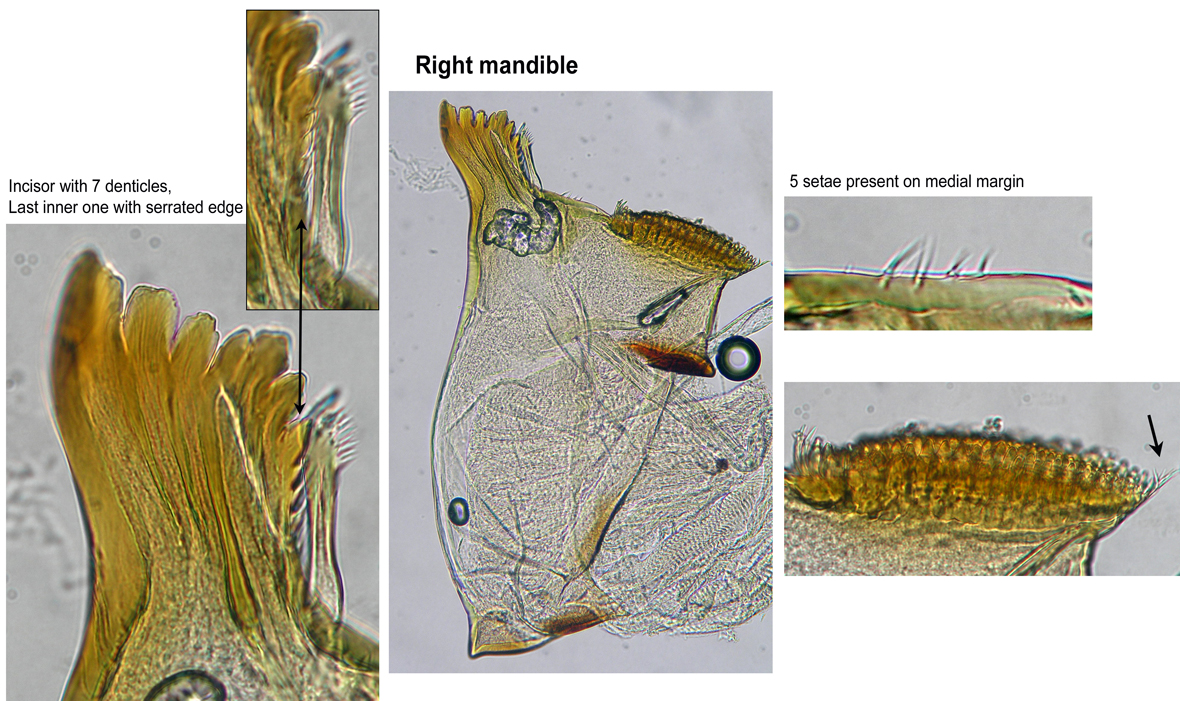 Right mandible