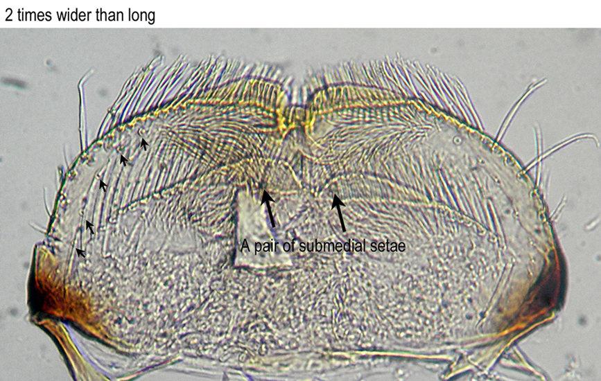 Labrum