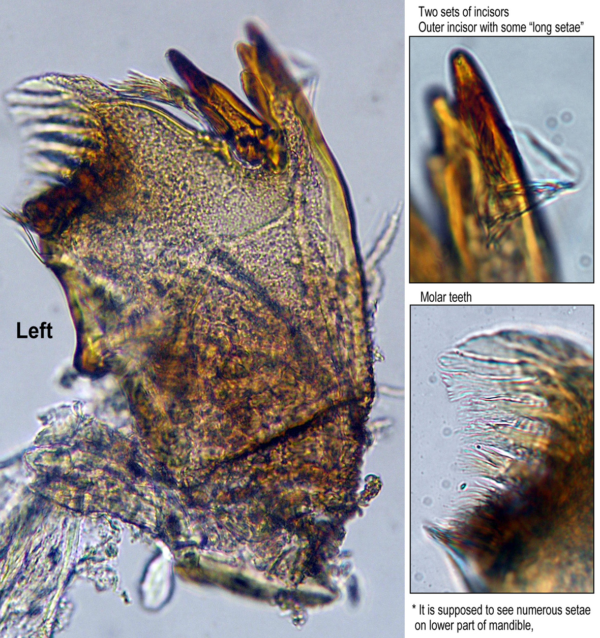 Left mandible