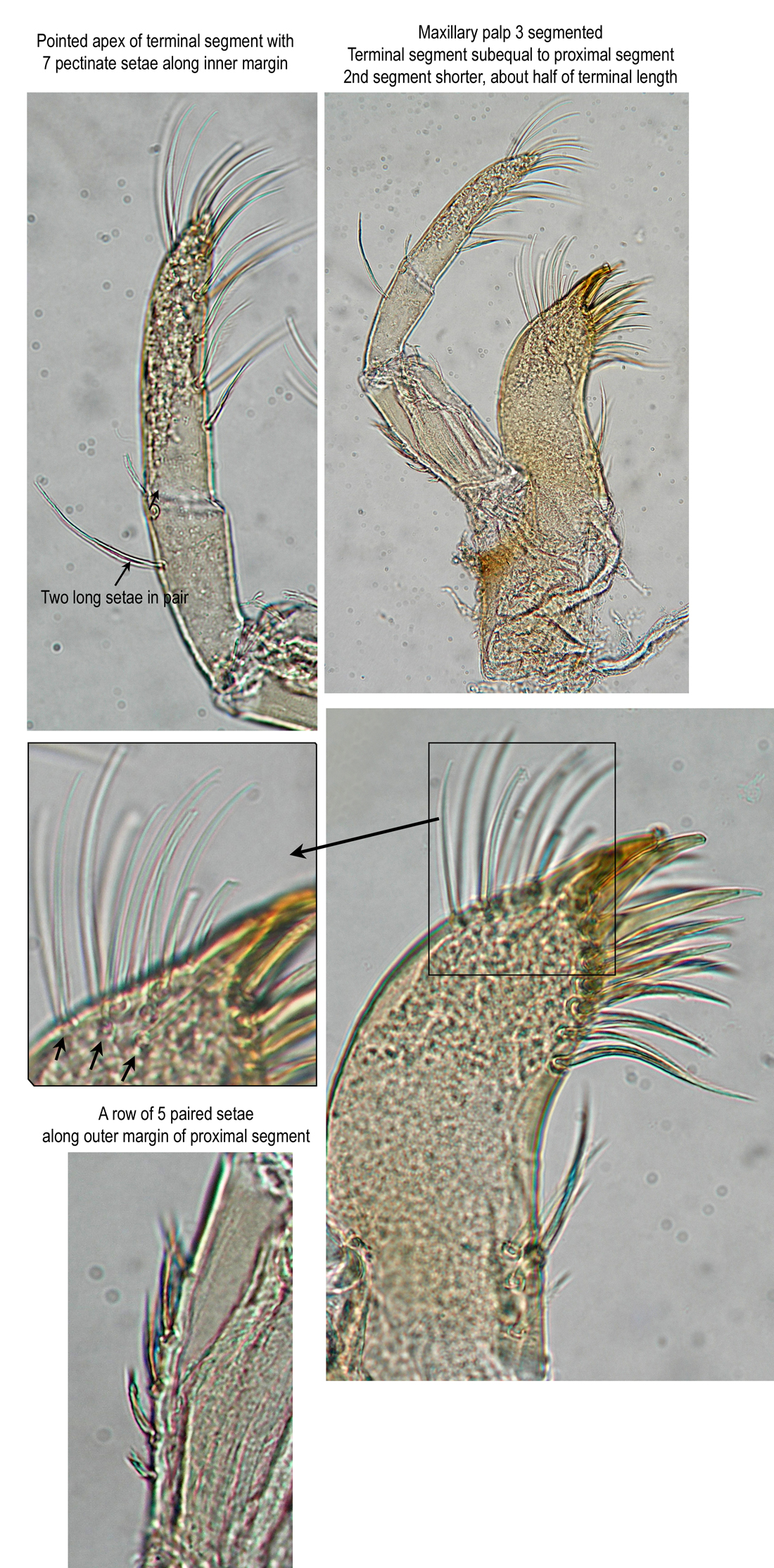 Maxilla