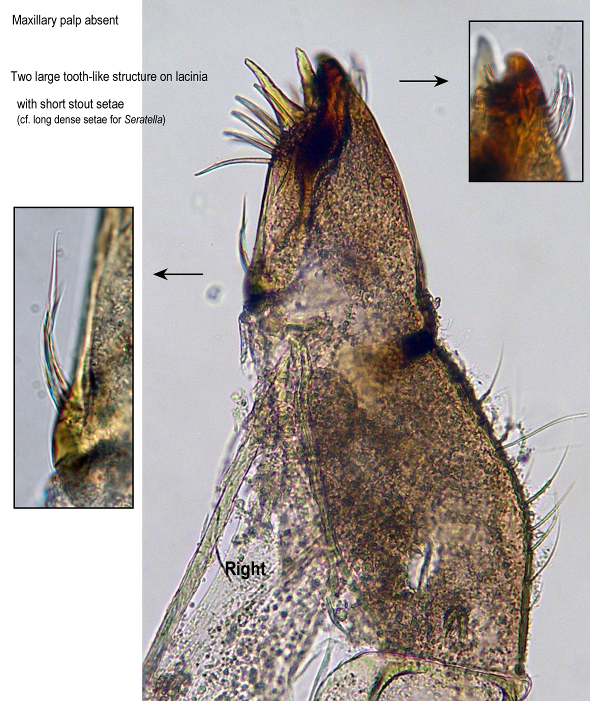 maxilla right