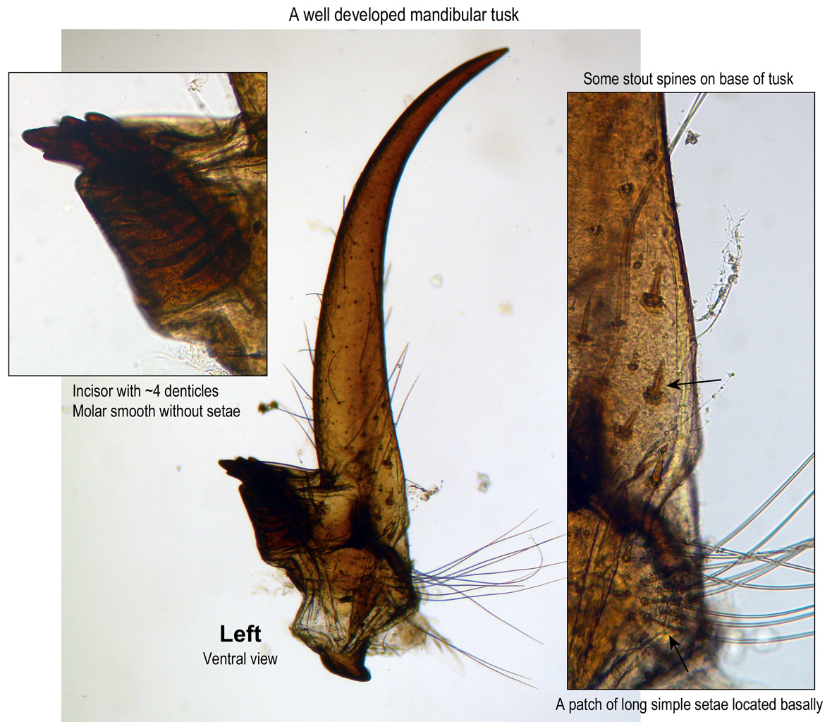 Left mandible