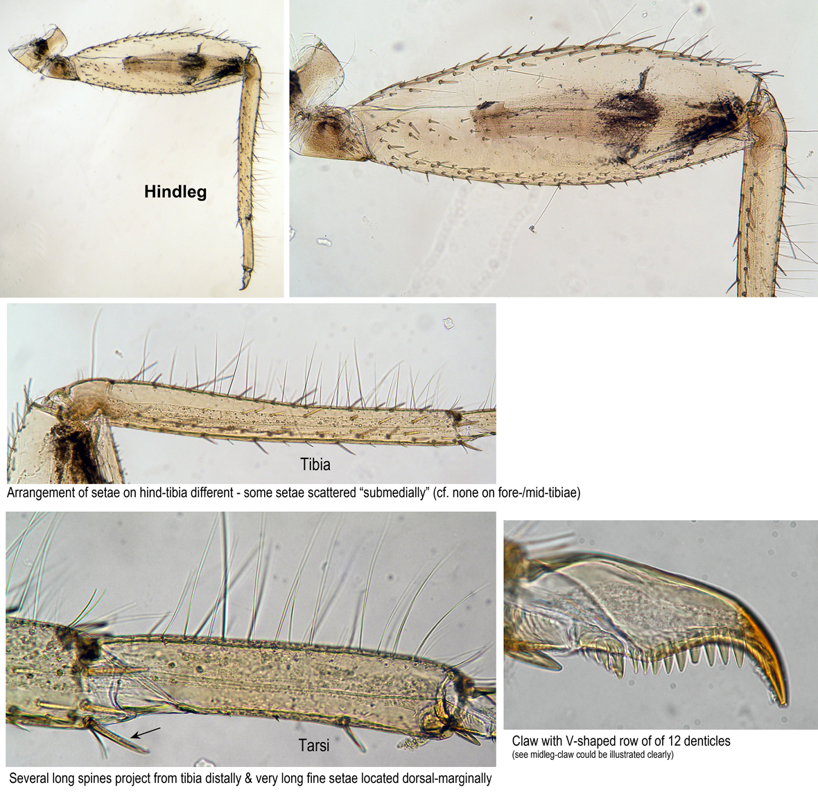 Hindleg