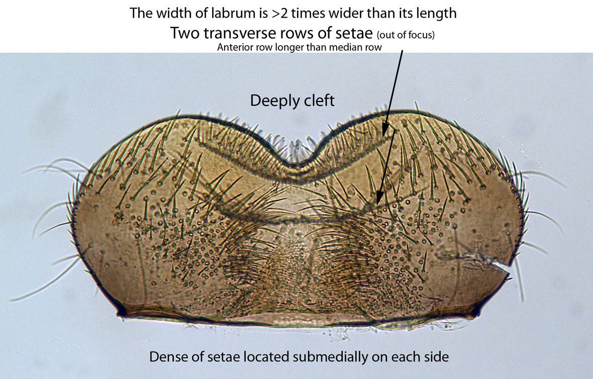 Labium