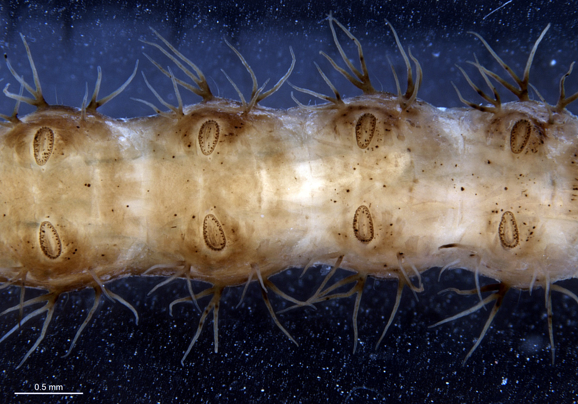 Abdominal segments in lateral view