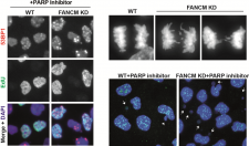 HKU Researchers Sheds Light on Overcoming Cancer Drug Resistance Unlocking Potential to Expand Use of PARP Inhibitors Across Cancer Types